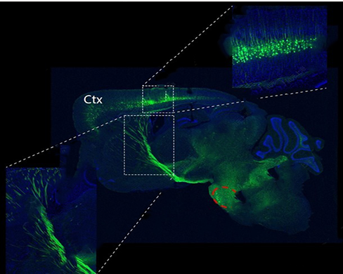 Carbon 13 cho công nghệ Tracer