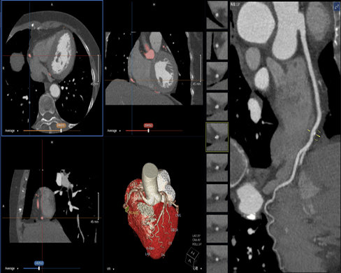 Il germanio può essere utilizzato nella produzione di agenti di imaging stereo nella diagnostica medica